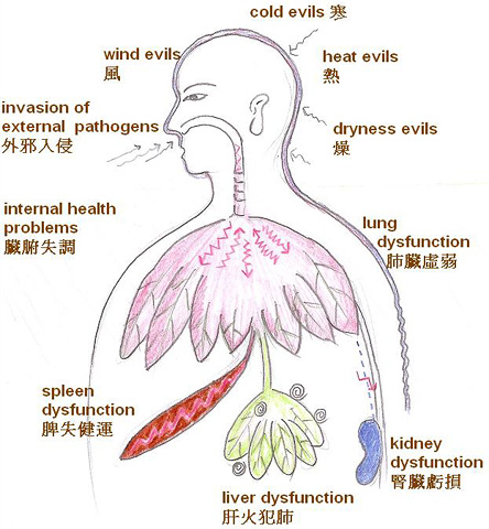 TCM views on the development of coughing.