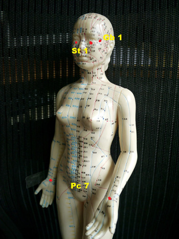 Acupuncture points for itchy eyes