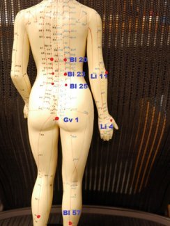 肛門瘙癢針刺穴位 肛門瘙癢針刺穴位