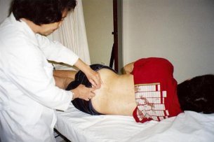 Acupuncture Treatment