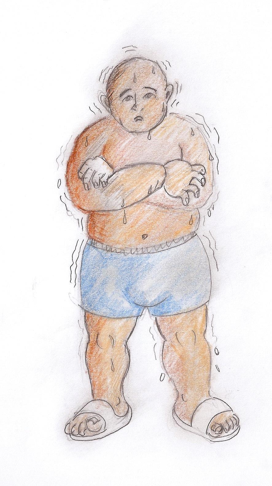 氣虛自汗者常伴有怕冷、神疲,氣短等症狀