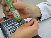 Physician applying moxa-heating on a needle to warm to the area.