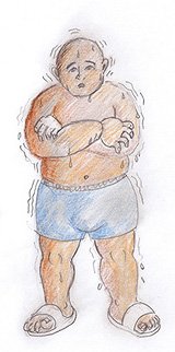 In TCM experience, sweat heavily over the entire body tends to have a low level of qi (vital energy) which makes people experience chills, breath shortness, fatigue and get cold and flu easily.