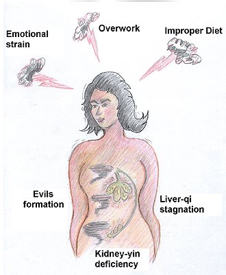 Development of PMS from a TCM perspective.