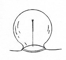 sizesNeedling in combination with cupping