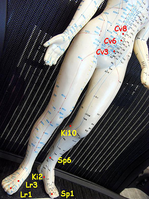 Acupuncture points for dysfunctional uterine bleeding 