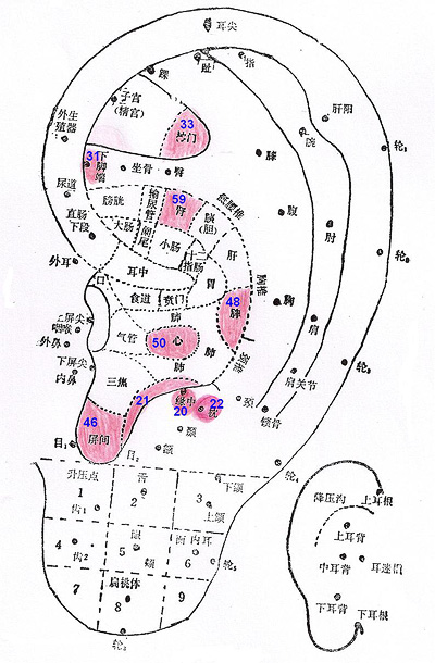 Auricular points for insomnia 