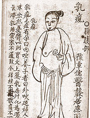 Breast abscess