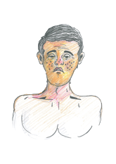 damp_heat_type-1