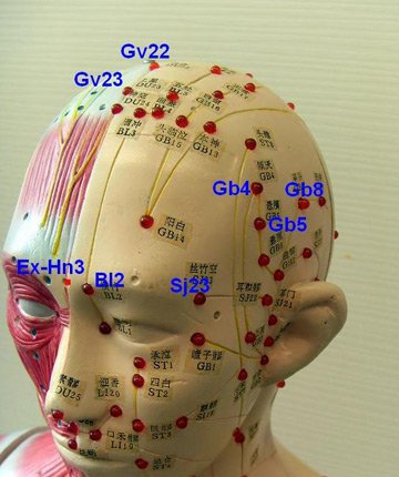 headache_acupoints3