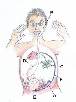 Development of impotence from a TCM perspective. A.debility of the vital gate fire B. fear and fright damaging the kidneys C. stagnation of liver-qi D. spleen and heart deficiency E. downward accumulation of dampness-heat F. obstruction from blood stasis