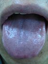 The tongue has a purple color.