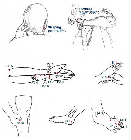 Body points help insomnia
