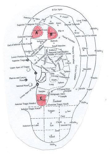 A. Endocrine B. Shen-men C. Internal genitalia
