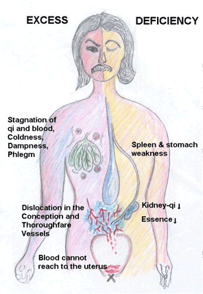 Pathological development of missed periods from a TCM perspective