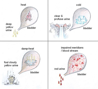 TCM checks bodily balance by assessing the nature of urine.