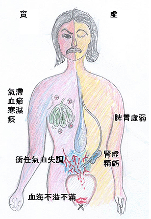 中醫觀點看閉經的病機