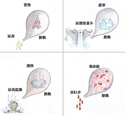 中醫會根據小便的性質來診察病情