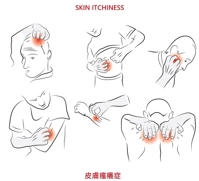 Itchiness, also known as pruritus, is an uncomfortable sensation that triggers the urge to scratch.