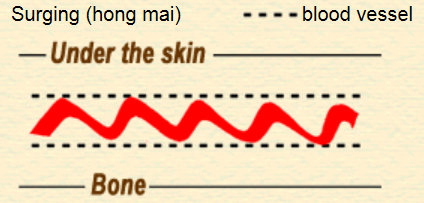 Surging pulse (hong mai)