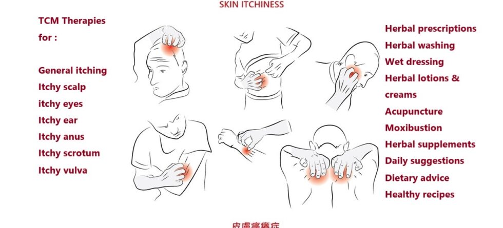 Itchiness and Chinese Medicine